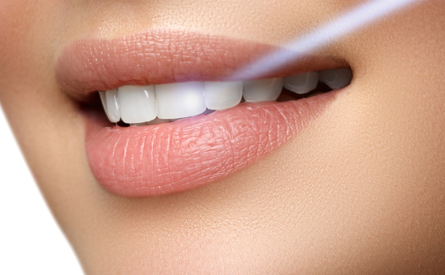 Laser-Dental-Procedures