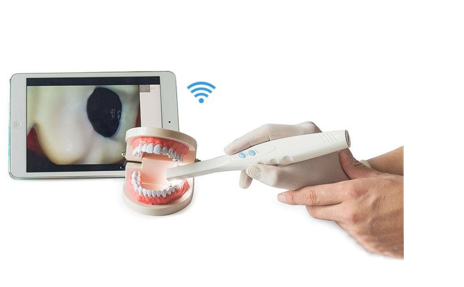 intra-oral-camera